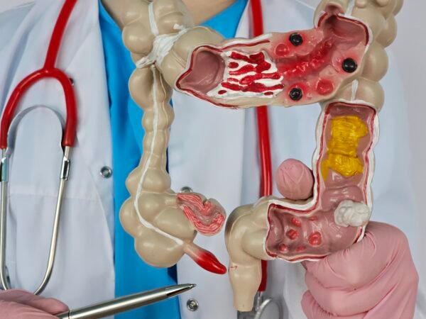 صورة توضيحية لصحة الجهاز الهضمي ومشاكله الشائعة